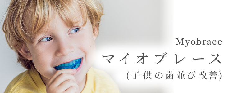 マウスピース　myobrace T2  マイオブレース Myobrace for Teens | 子どものマウスピース矯正