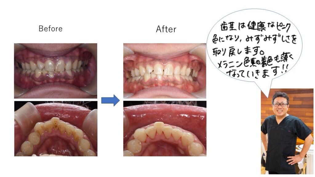 禁煙による効果