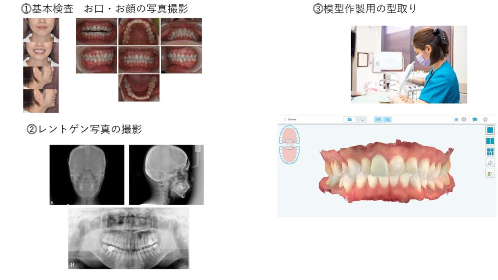 精密検査イメージ