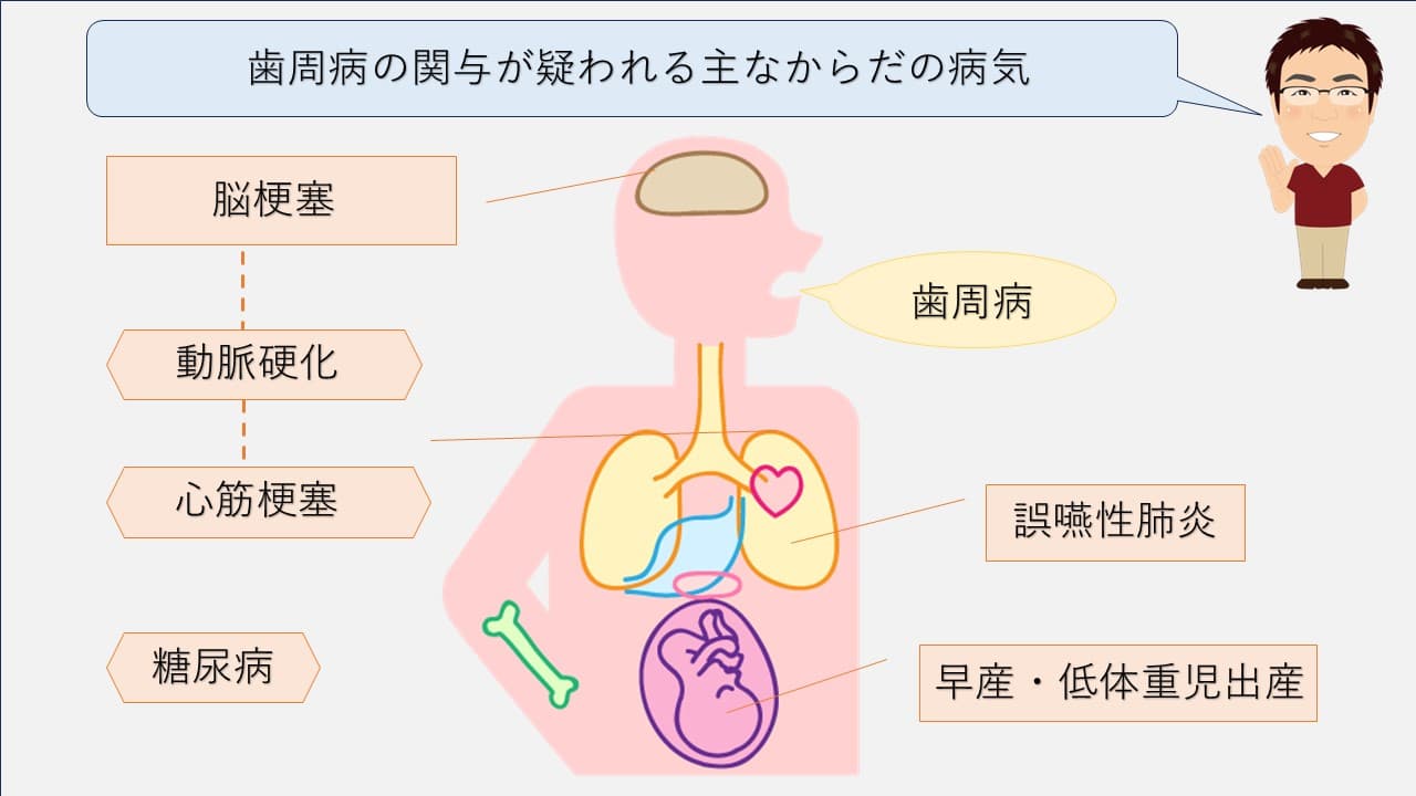 歯周病と全身疾患