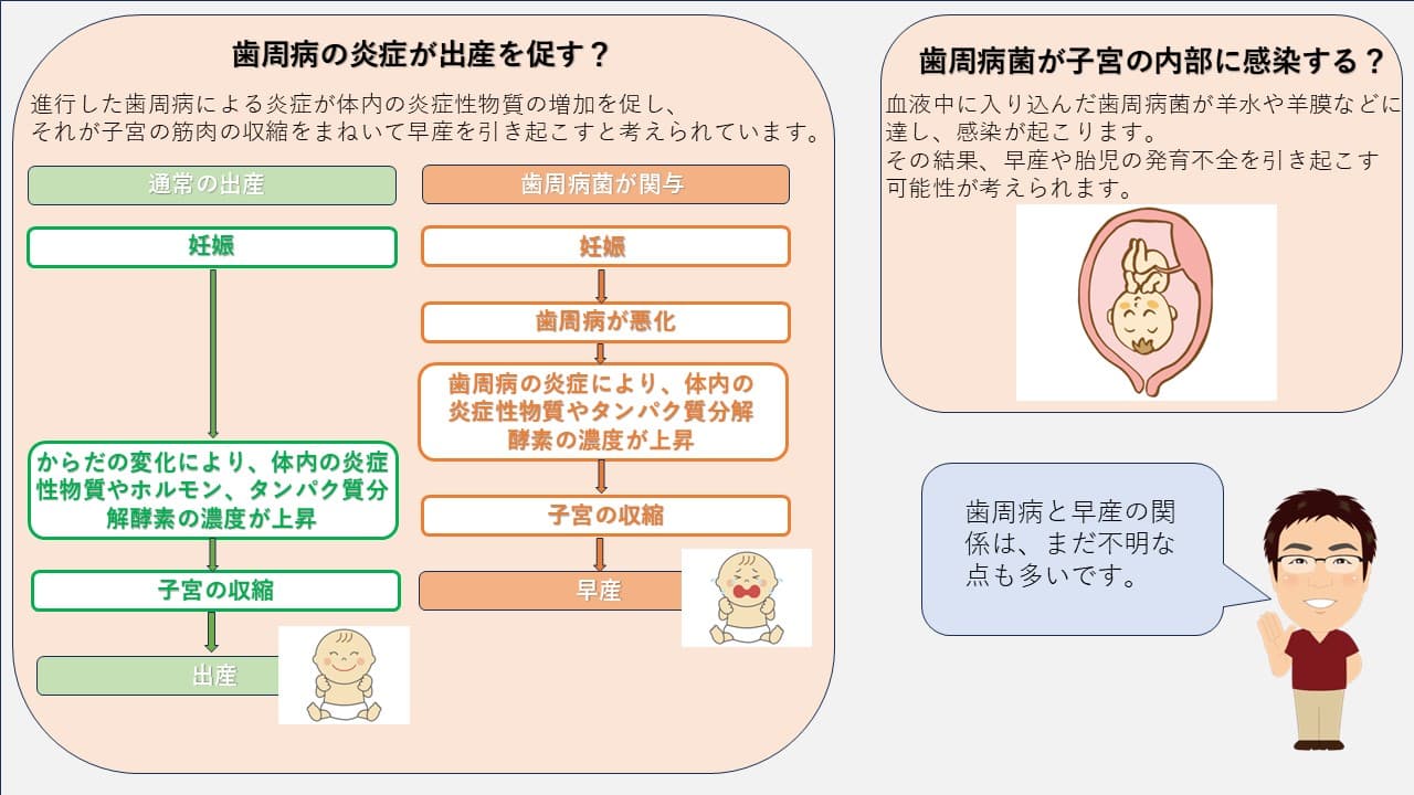 歯周病が引き起こす妊婦へのリスク