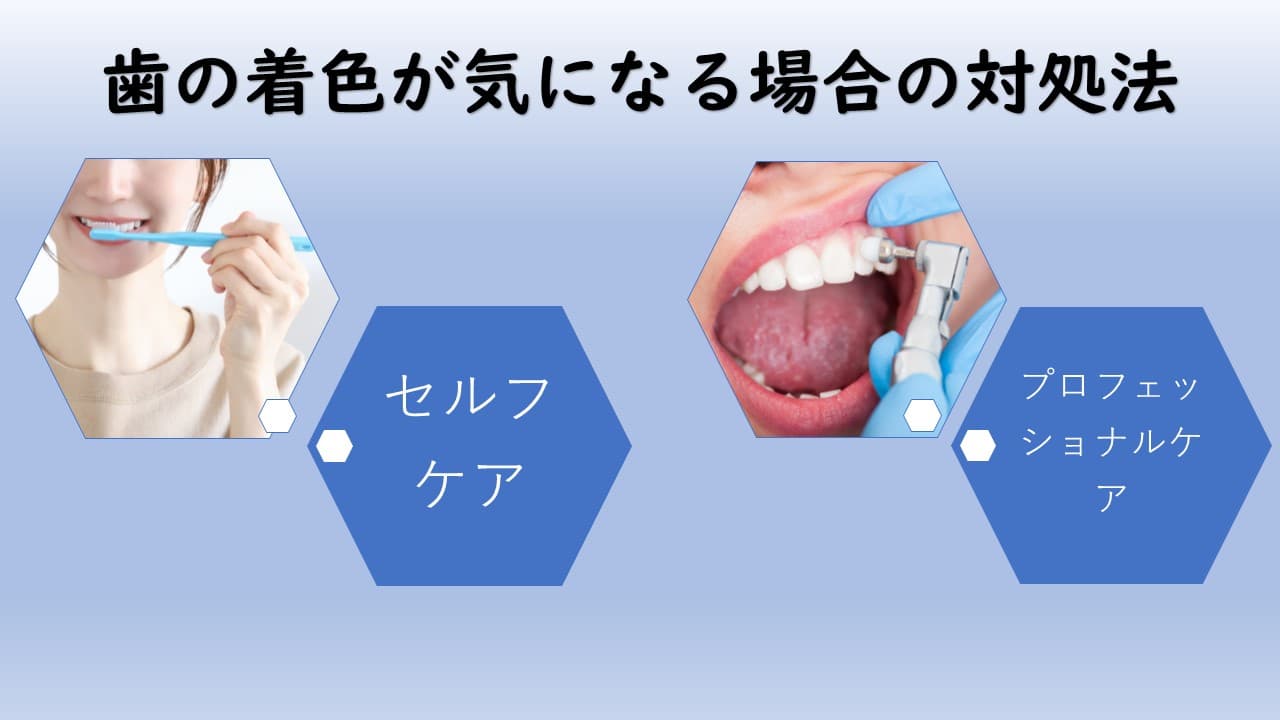 歯の着色が気になる場合の対処法