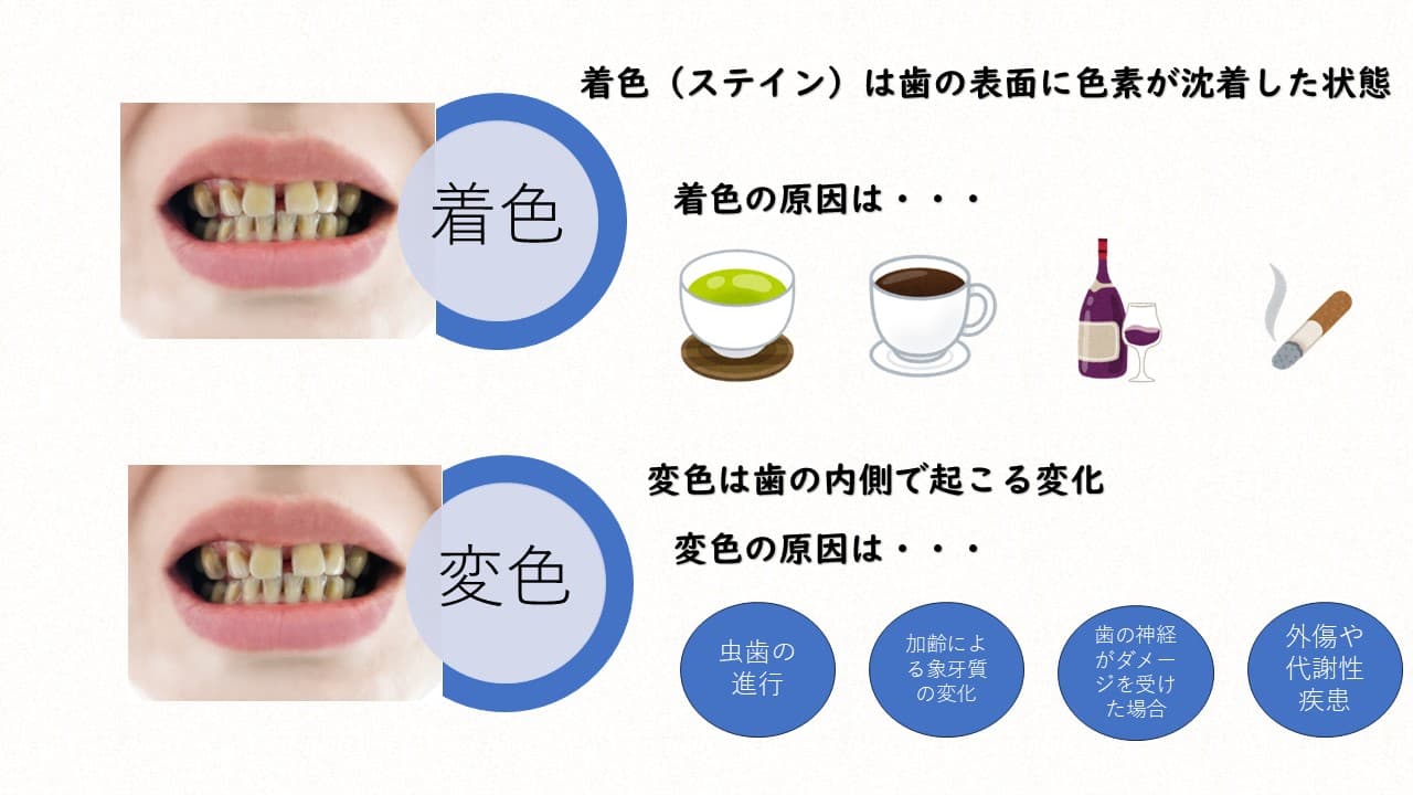 着色と変色の違い