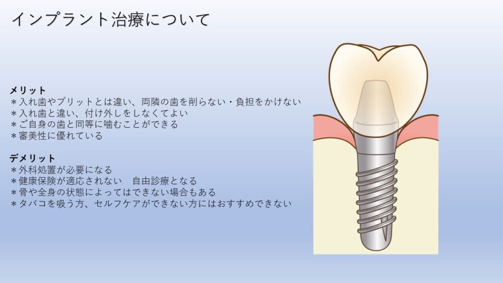 インプラント治療について