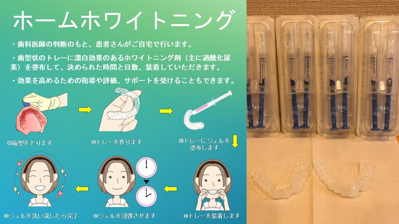 ホームホワイトニング