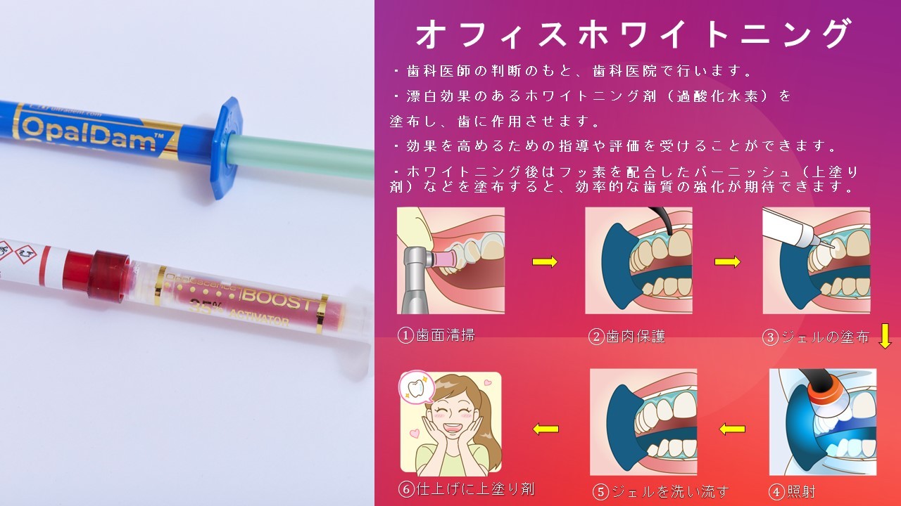 オフィスホワイトニング