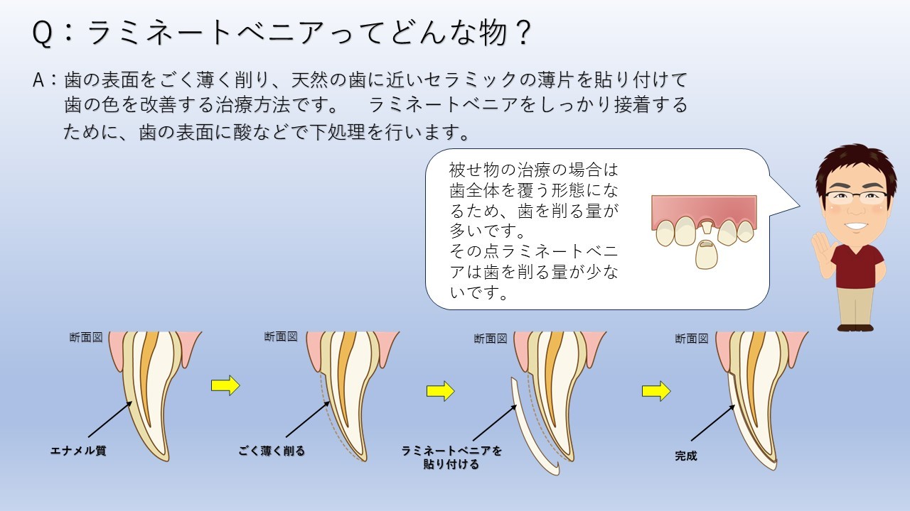 ラミネートニベアの説明