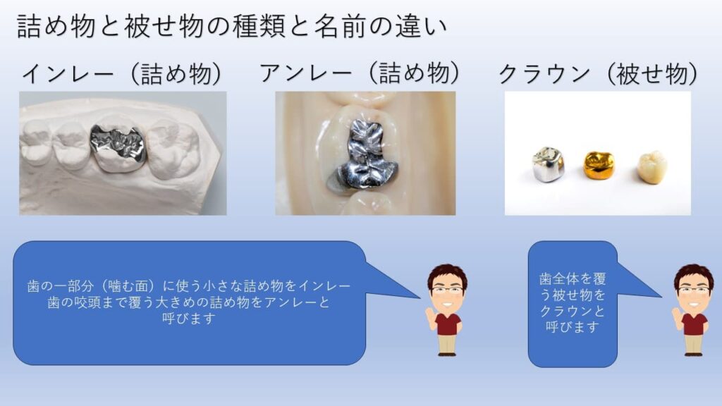 詰め物と被せ物の違い