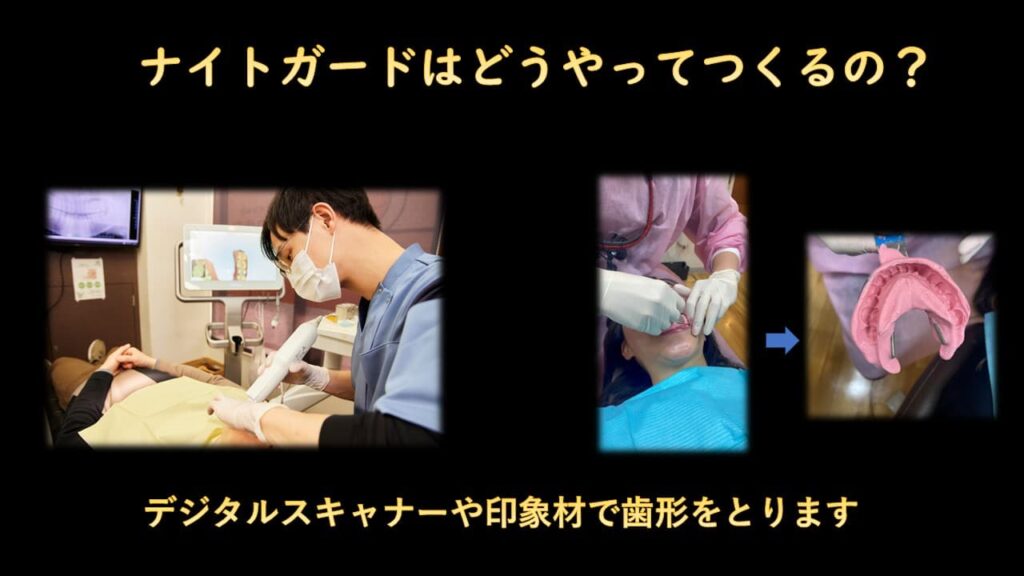 ナイトガードの作り方