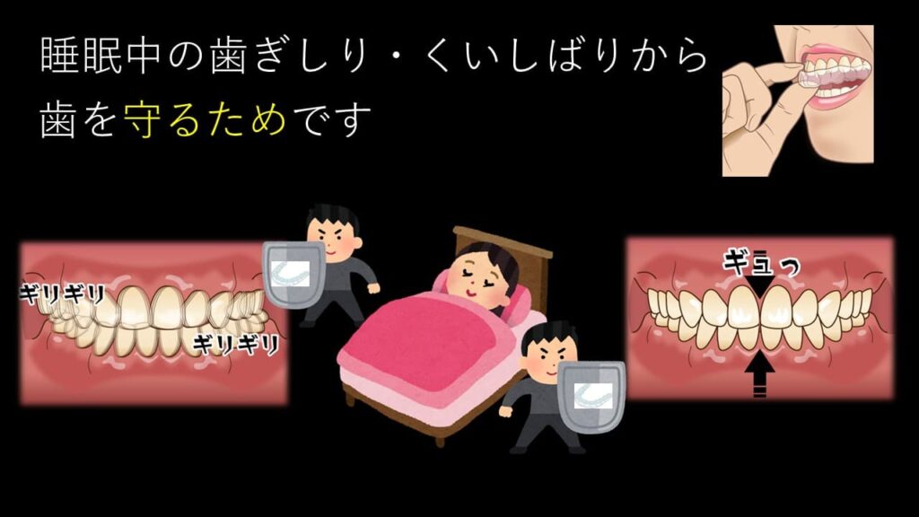 ナイトガードで歯を守るイメージ
