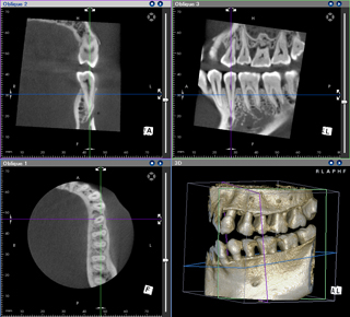 CT２